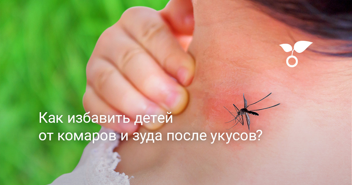 Как избавить детей от комаров и зуда после укусов?