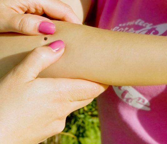 Что делать, если укусил клещ?