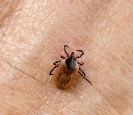 Как защитить себя и детей от клещей?