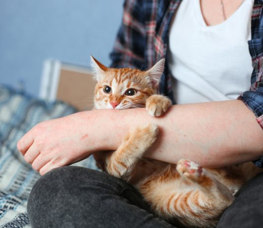 Чем опасна обычная кошка: 3 болезни от простых царапин и укусов - Животные Чем опасна обычная кошка: 3 болезни от простых царапин и укусов.