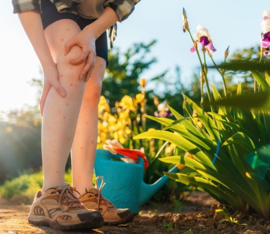 Как отдохнуть на природе без укусов насекомых и клещей - Животные Как отдохнуть на природе без укусов насекомых и клещей.