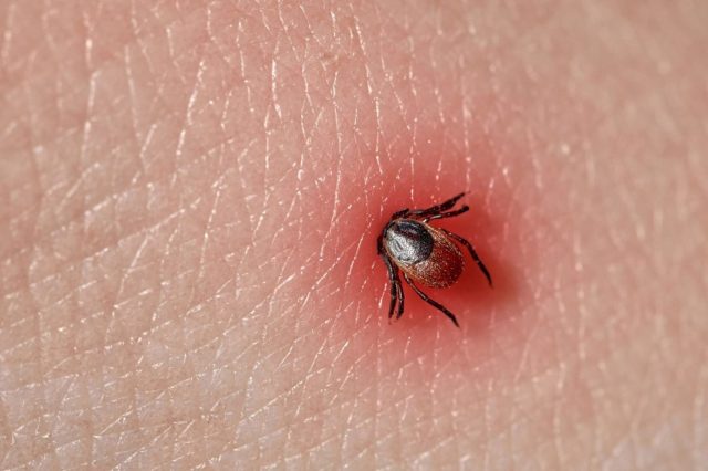 Клещевой укус опасен не только в момент обнаружения паразита. После удаления часто требуется наблюдение у врача, анализ клеща и контроль самочувствия, особенно если участок находится рядом с лесом или высокой травой.